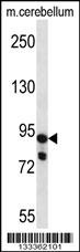 USP45 Antibody