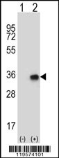 CNOT8 Antibody