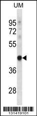 TRUB1 Antibody