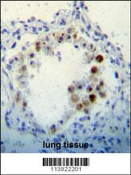 CDKN2B Antibody