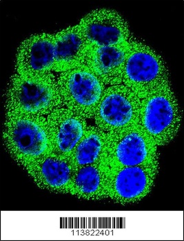 CDKN2B Antibody