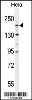 COL4A2 Antibody
