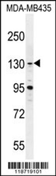 GLTSCR1 Antibody