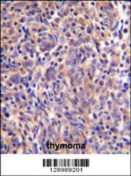 THEMIS Antibody