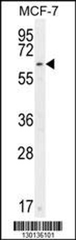CTDSPL2 Antibody