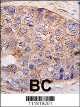 UBTD1 Antibody