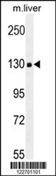 COL18A1 Antibody