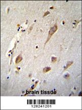 NXNL2 Antibody