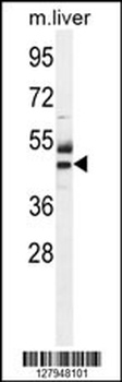 CTU1 Antibody