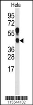 PRMT1 Antibody