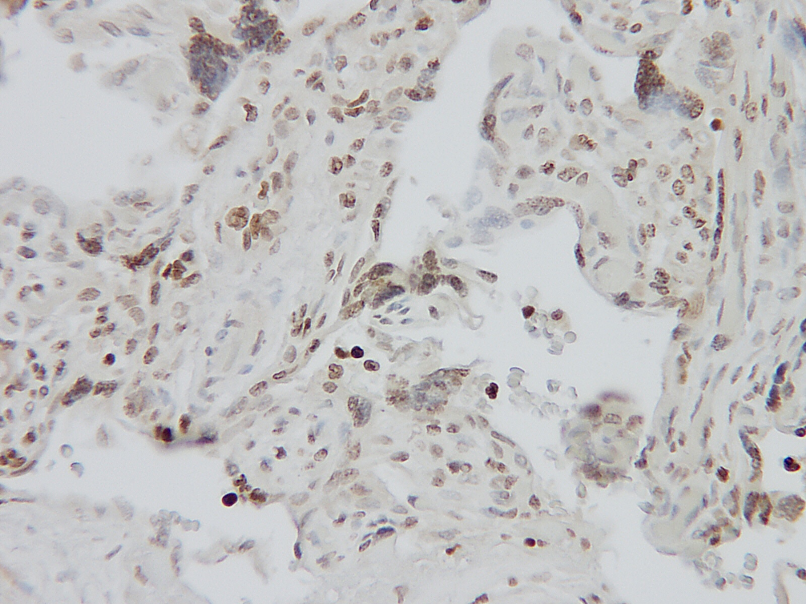 CCL18 Antibody