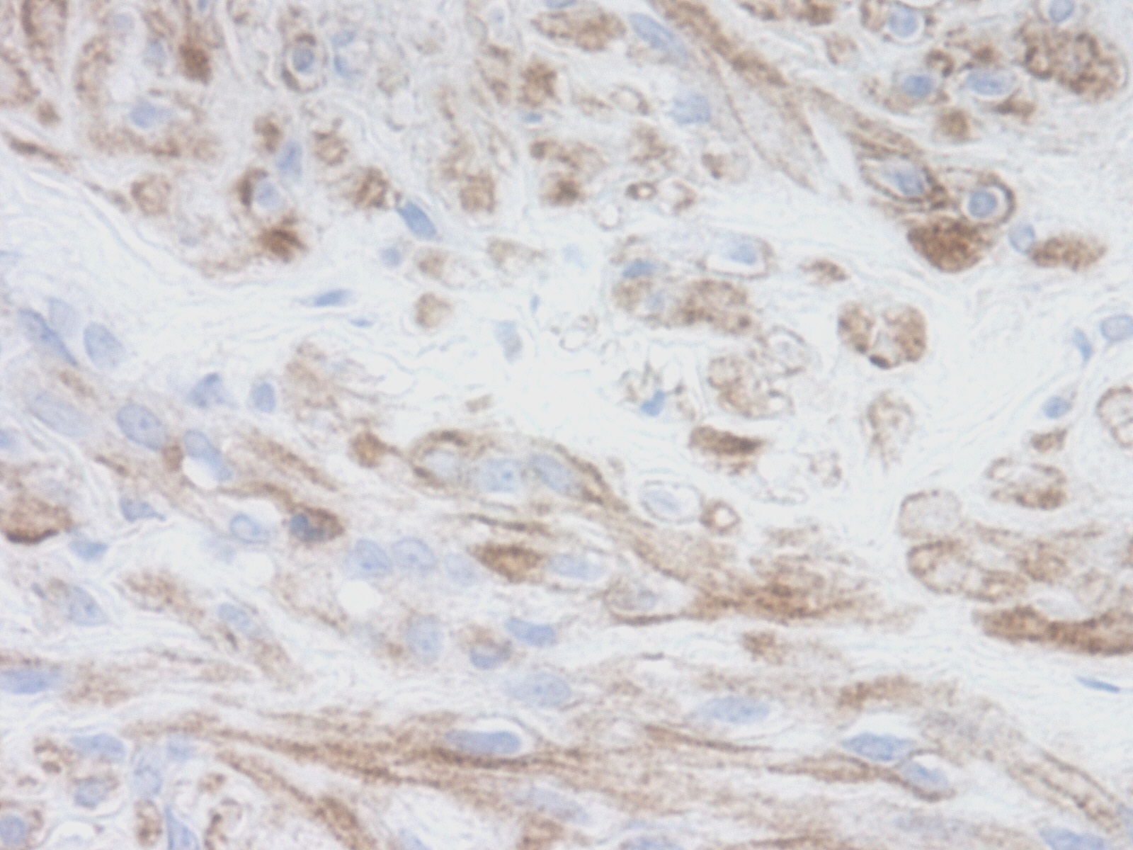 CXCL11 Antibody