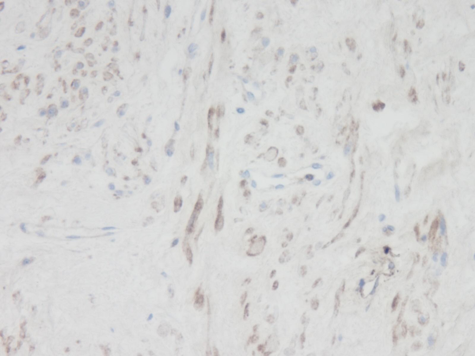 CXCL11 Antibody