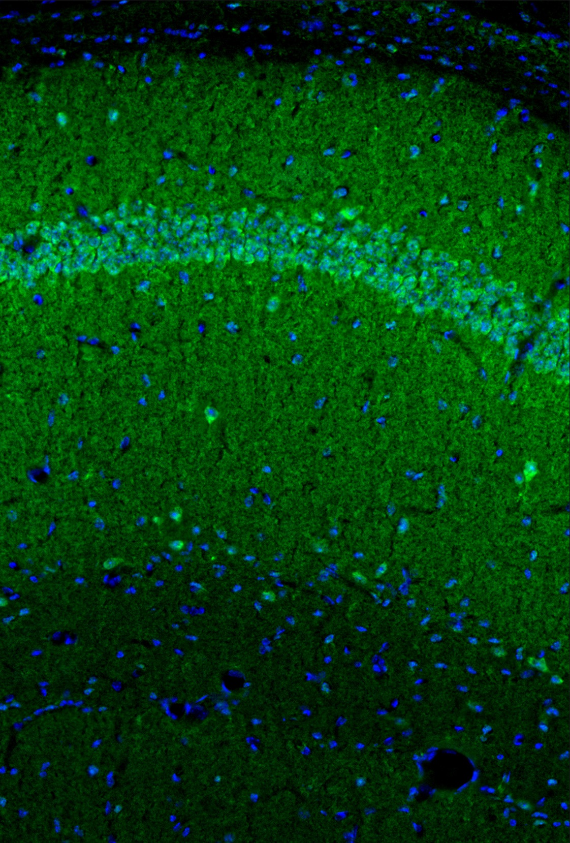 Cxcl10 Antibody