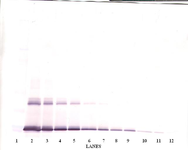 Il6 Antibody