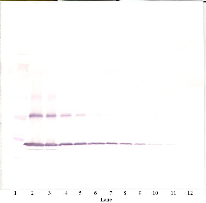 Il1b Antibody