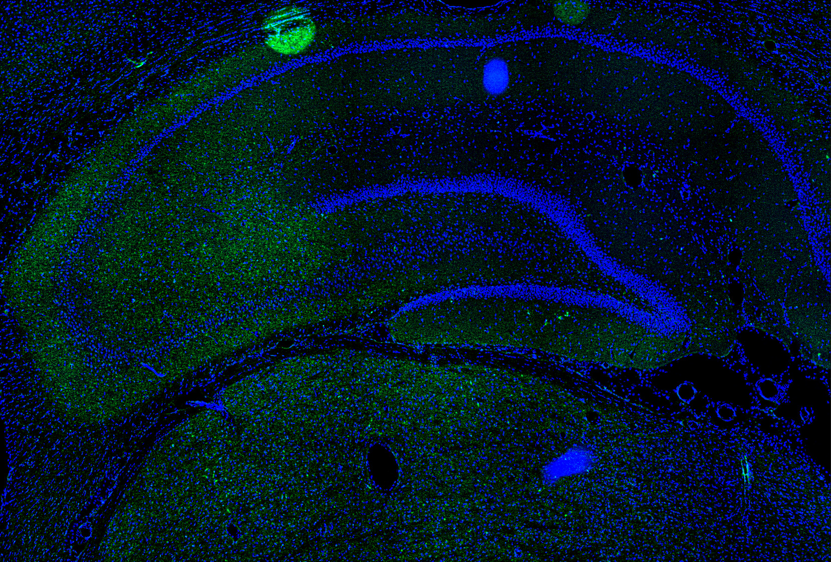 Il1a Antibody