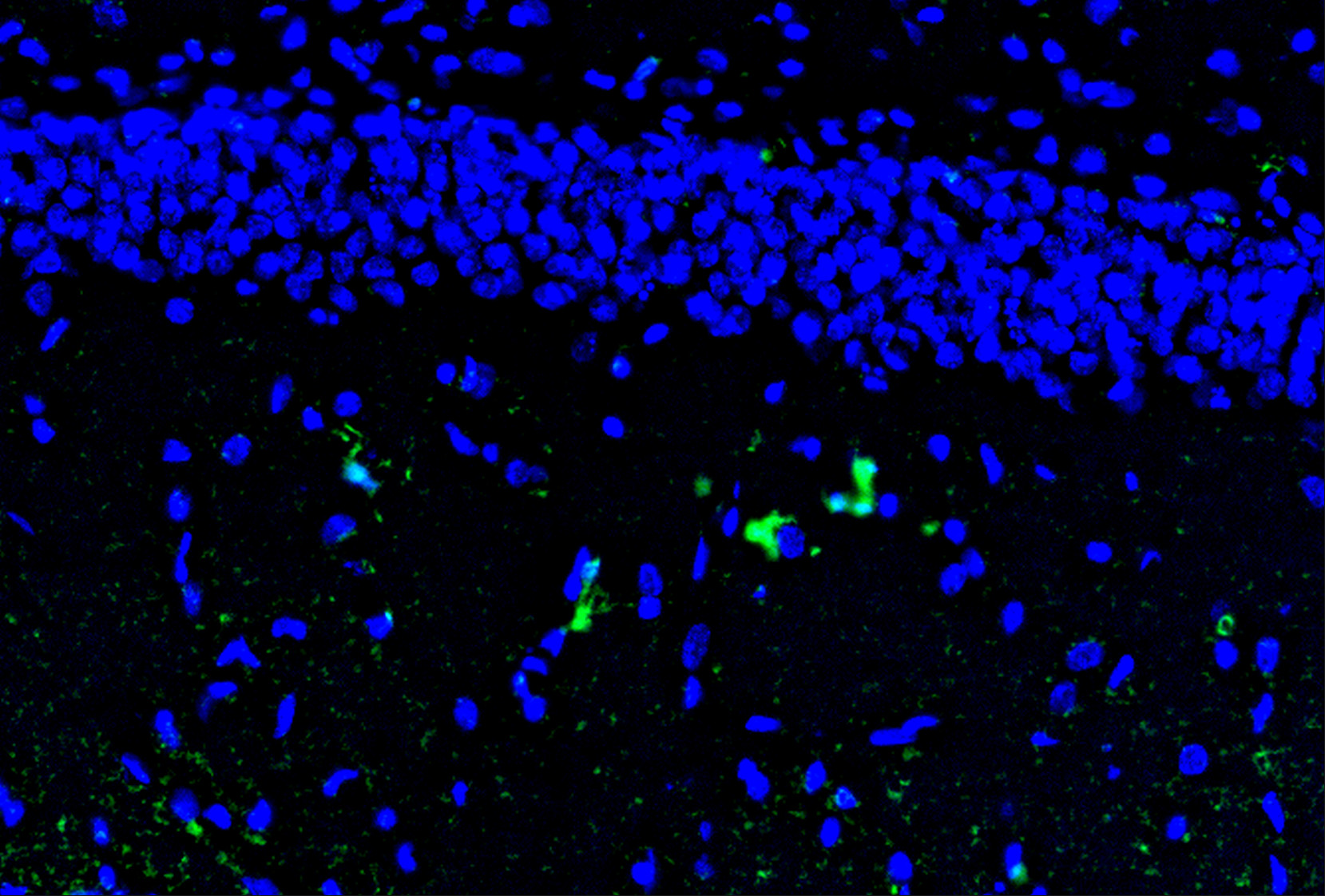 Il1a Antibody