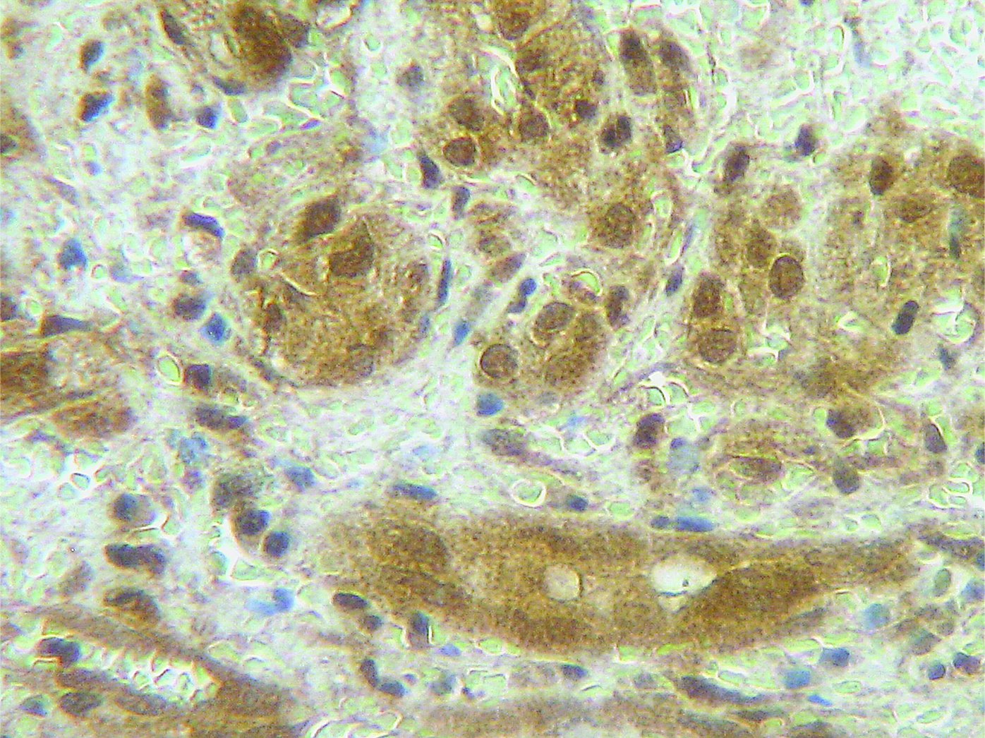ELANE Antibody