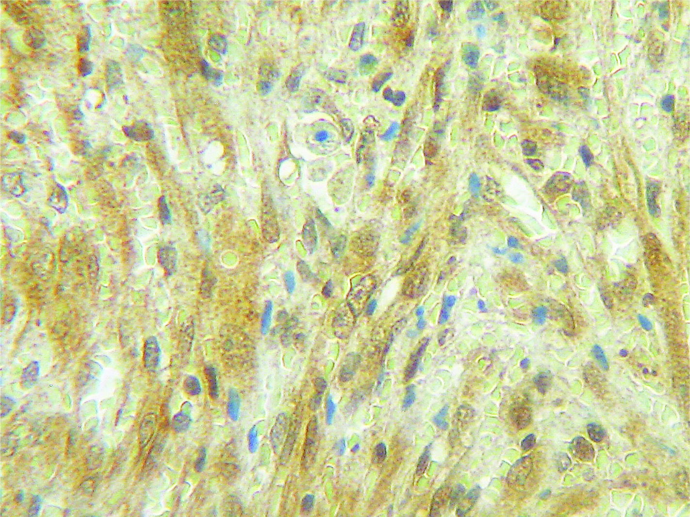 ELANE Antibody
