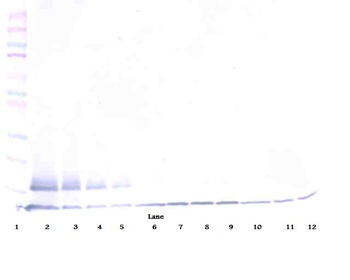TNFRSF10B Antibody (Biotin)