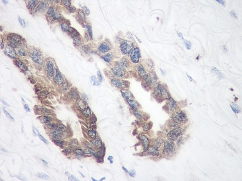 TIMP1 Antibody