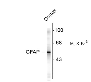 GFAP Antibody