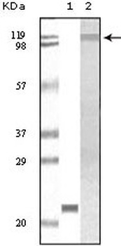 TYK2 Antibody