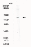 IFNAR2 Antibody