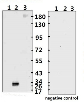SARS-CoV-2 (COVID-19) Spike RBD Monoclonal Antibody [B002]