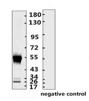 SARS-CoV-2 (COVID-19) Nucleocapsid Monoclonal Antibody [N015]