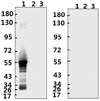 SARS-CoV-2 (COVID-19) Nucleocapsid Antibody