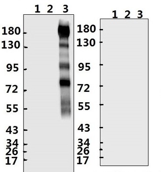 SARS-CoV-2 (COVID-19) Spike S2 Antibody (CT)