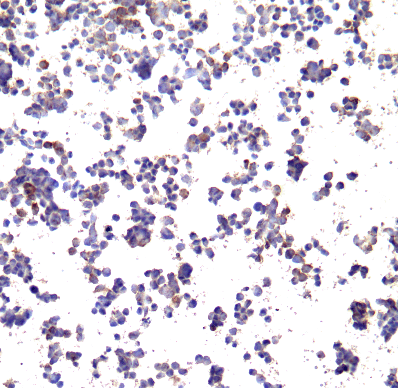 CD274 Antibody