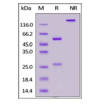 SARS-CoV-2 Spike RBD Antibody, monoclonal, Chimeric