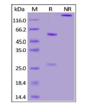 SARS-CoV-2 Spike NTD Neutralizing Antibody, monoclonal, Chimeric