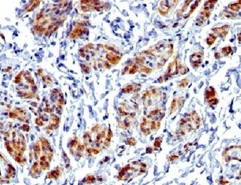CALD1 Antibody