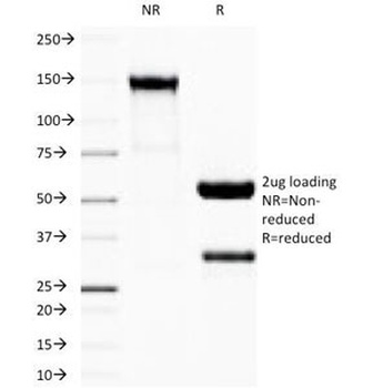 IGHG1 Antibody
