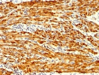 CNN1 Antibody