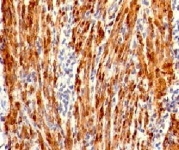 CNN1 Antibody