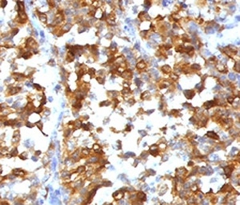 MLANA Antibody