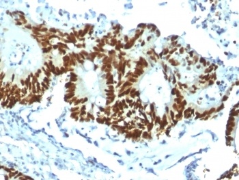 TP53 Antibody