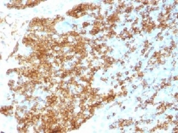 PTPRC Antibody