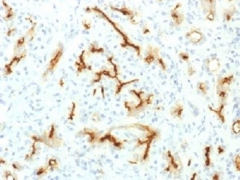 CFTR Antibody