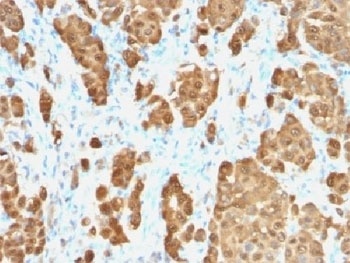 S100B Antibody