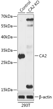 CA2 Antibody