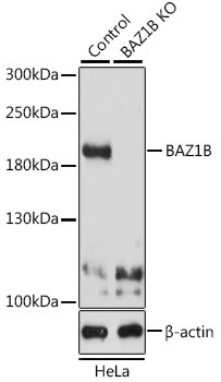 BAZ1B Antibody