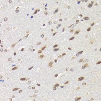 BAZ1B Antibody