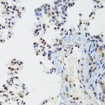 BAZ1B Antibody