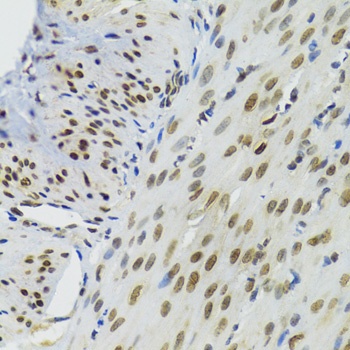 BAZ1B Antibody